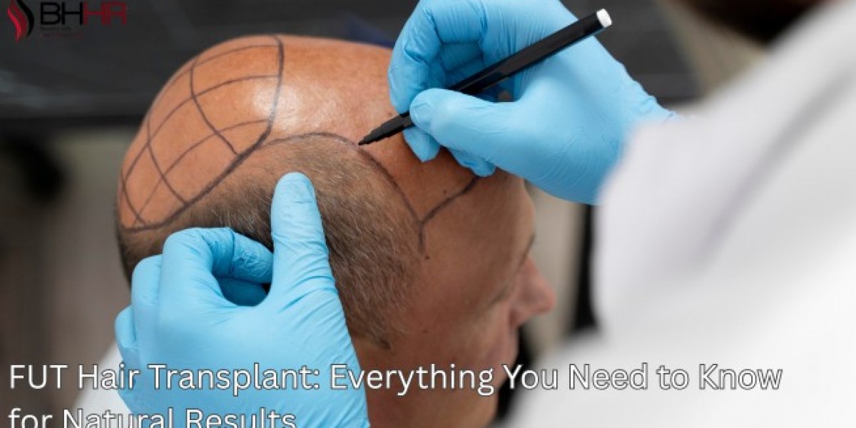 FUT Hair Transplant: Everything You Need to Know for Natural Results