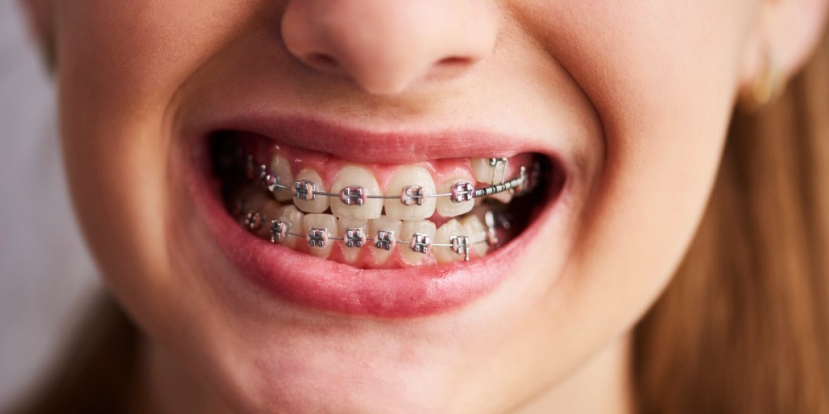 Comprehensive Care with a North Las Vegas Dentist