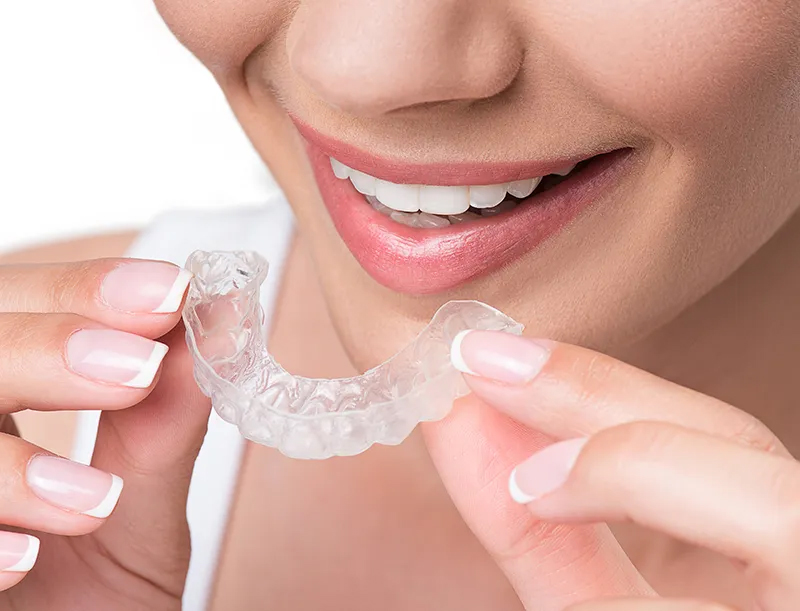 Invisalign in Upper Eastside | Lenox Hill | Midtown East Invisalign | Bryant Park