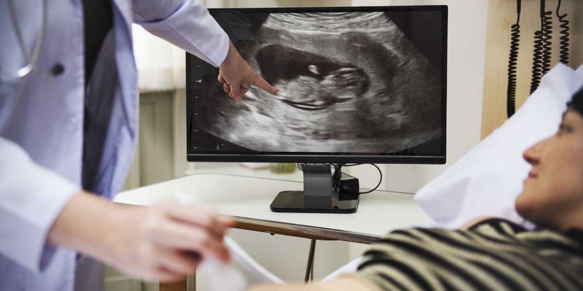 Tips for Amazing 3D 4D Ultrasound Photos at 29 Weeks Pregnant